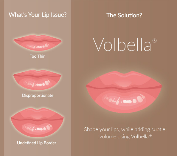 Volbella<sup>®</sup> from Tucson's Ironwood Dermatology can address a range of lip issues.