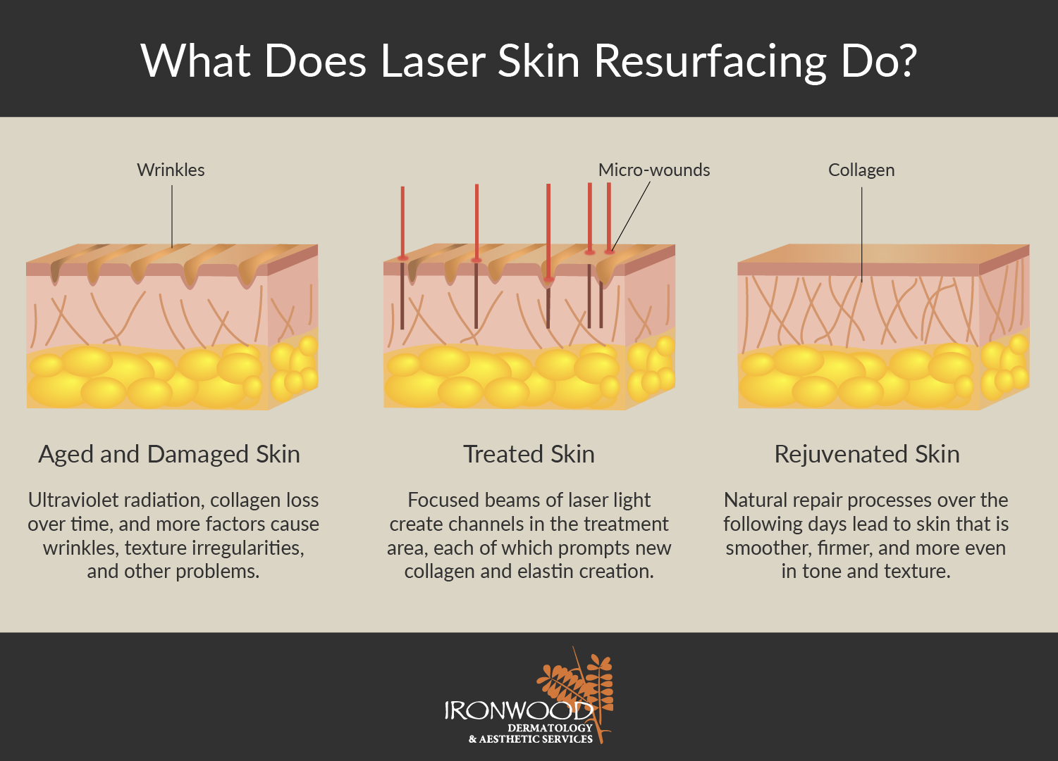 See laser skin resurfacing at Tucson and Oro Valley’s Ironwood Dermatology.